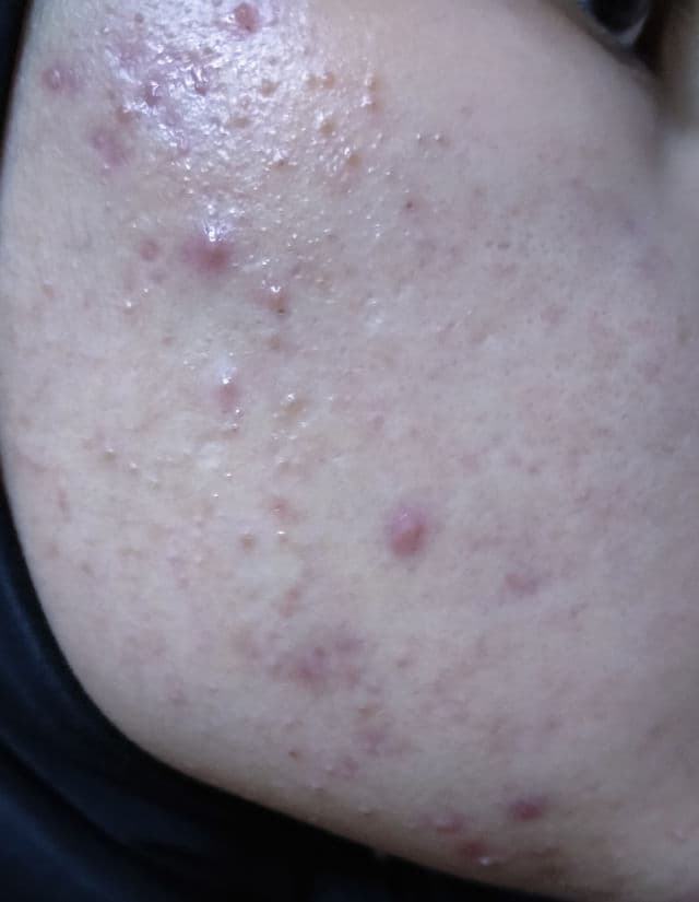 Somethinc 10% Niacinamide + Moisture Sabi Beet Serum review photo by sweetie