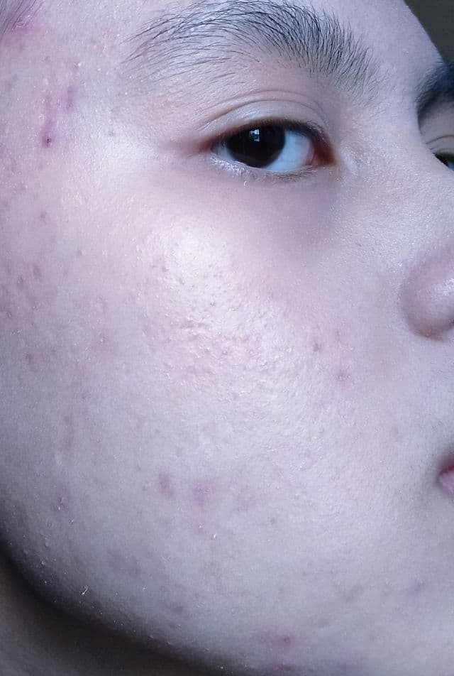 Somethinc 10% Niacinamide + Moisture Sabi Beet Serum review photo by sweetie
