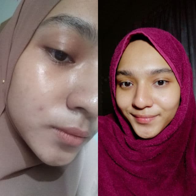 Alluskin Purifying Cleanser review photo by sykrhbdrl