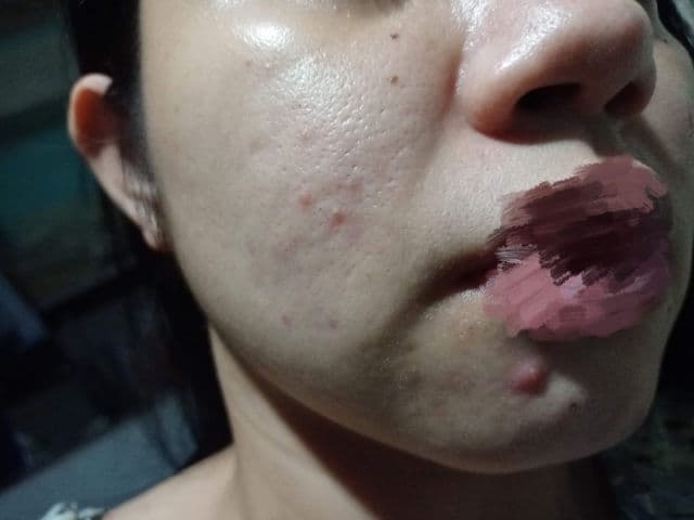 Dermorepubliq Snail Mucin + Botanical Extracts Clarifying Toner review photo by tyaraa