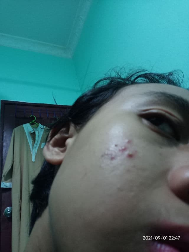 Cosmoderm Vitamin E Facial Cleansing Foam review photo by umais