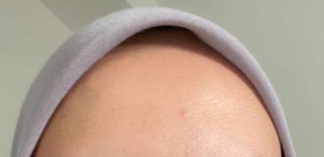 Alluskin Lightbulb Serum review photo by vavaaen