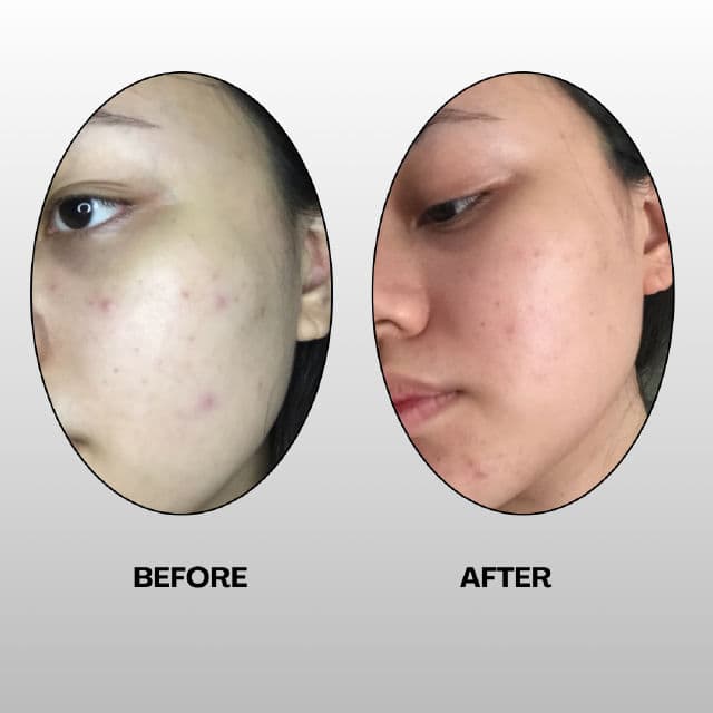 4PM Galactomyces Niacinamide Serum review photo by verii