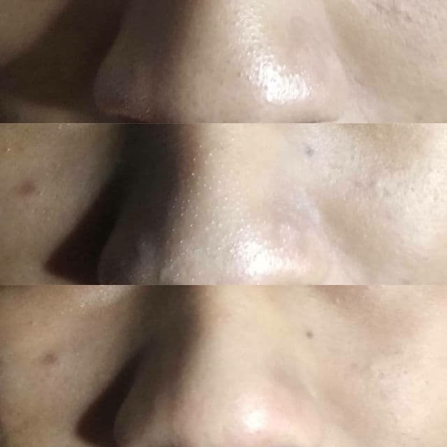 Skin game Pore Armor Mask review photo by vosmeyu