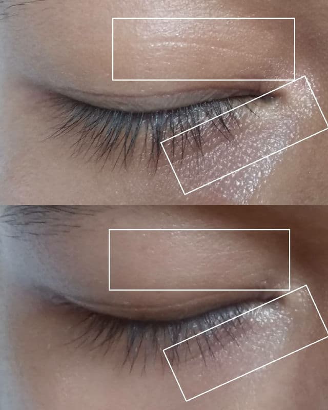 Sbcskin Eye Cream Treatment review photo by vosmeyu