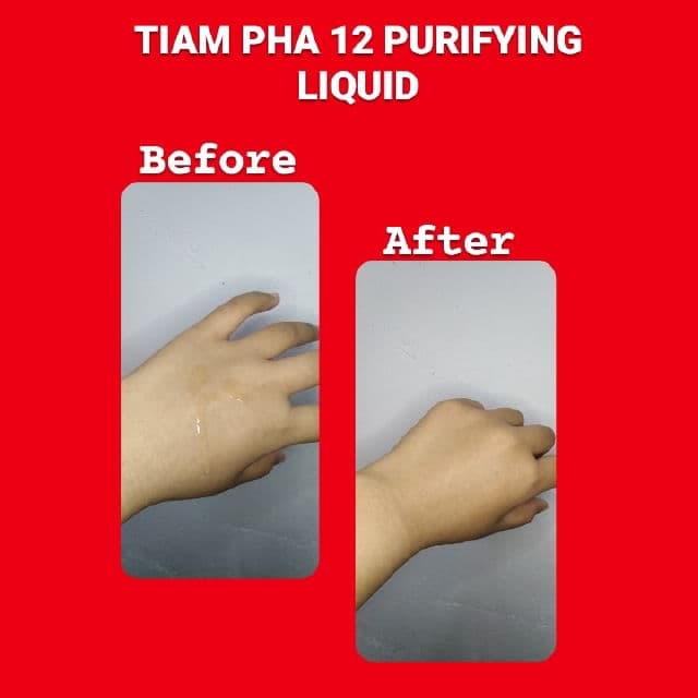 TIAM AC Fighting PHA 12 Purifying Liquid review photo by xxygirl
