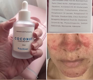 Bellflower Coconut Hydrating Serum review photo by ypalmd