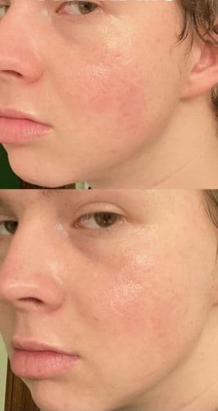 Avocado Ceramide Recovery Serum product review