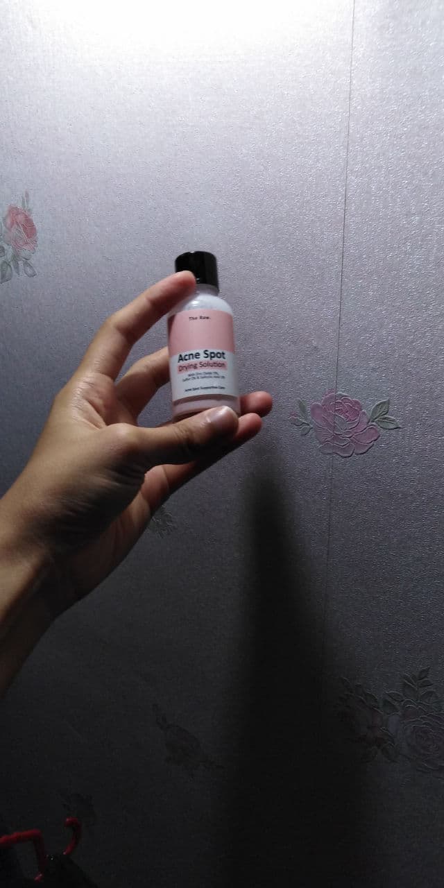 The Raw. Acne Spot Drying Solution review photo by zatiezamri