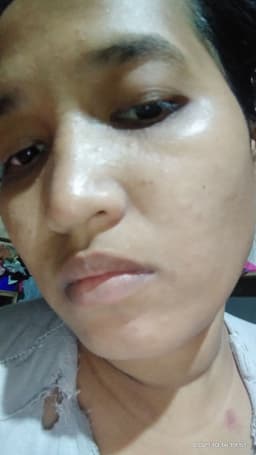 ayuepicky