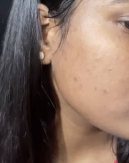 ish25