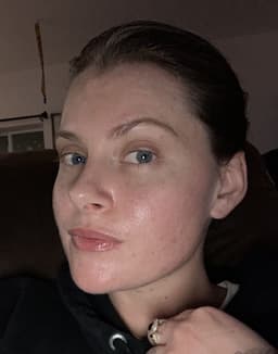 AllSkinIsBeauty
