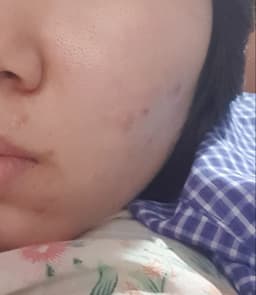 Cravingforglowskin
