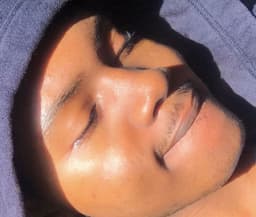 MrSkincare