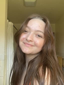 Baileyyskin