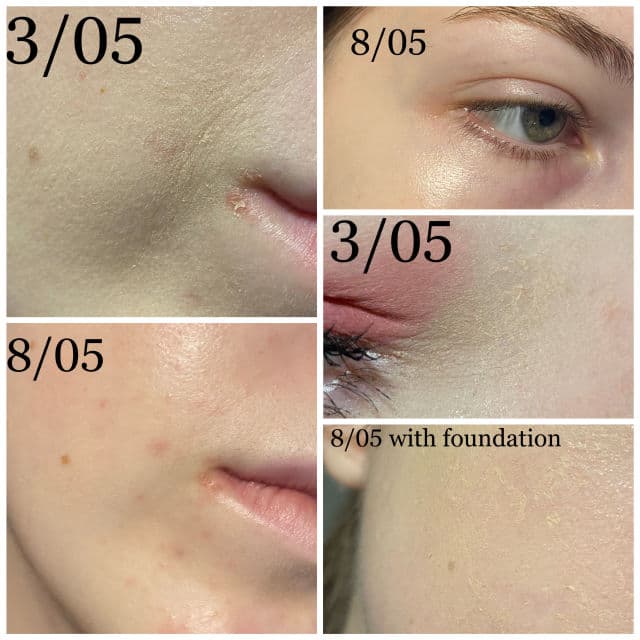 Madagascar Centella Probio-Cica Enrich Cream product review