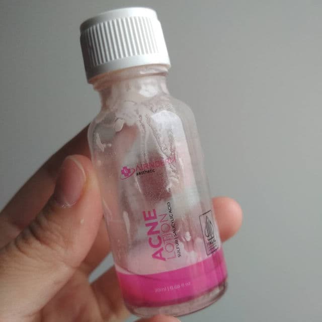 Airnderm Aesthetic Acne Lotion review photo by YuniQ
