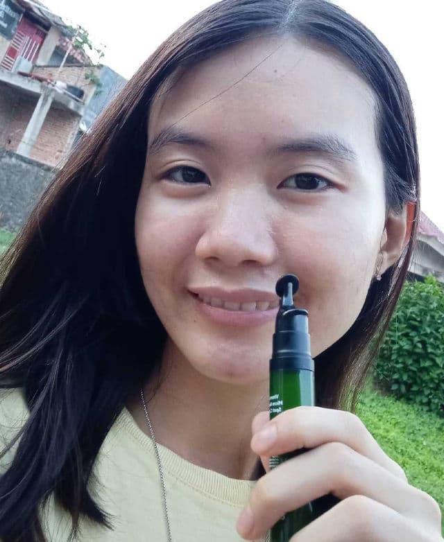 COMMONLABS Vitamin E Micro Needle Spot Cream review photo by Sherlianachr
