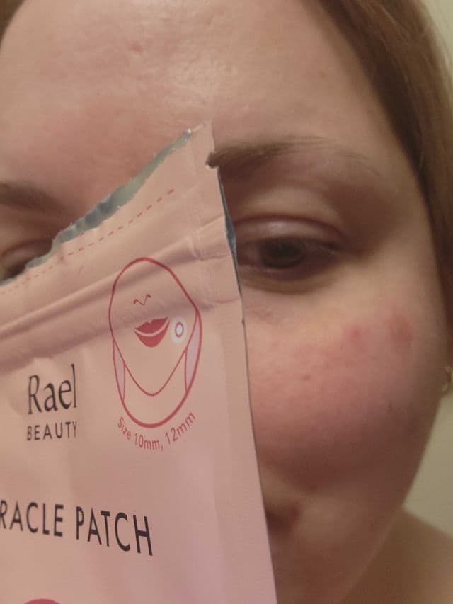 Rael Miracle Patch Invisible Spot Dot review photo by JosieFauteux