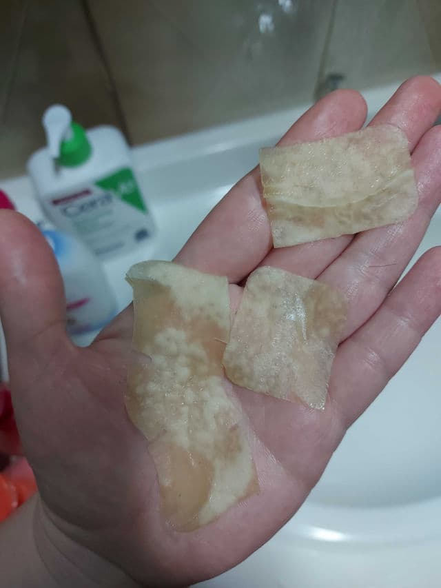 Peace Out Pore Strips review photo by villemo20