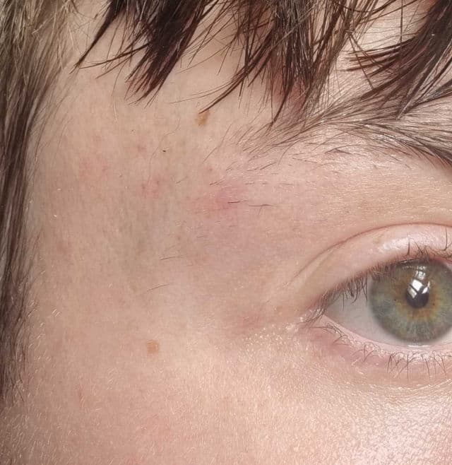 The Inkey List 15% Vitamin C and EGF Brightening Serum review photo by Aidenpkb