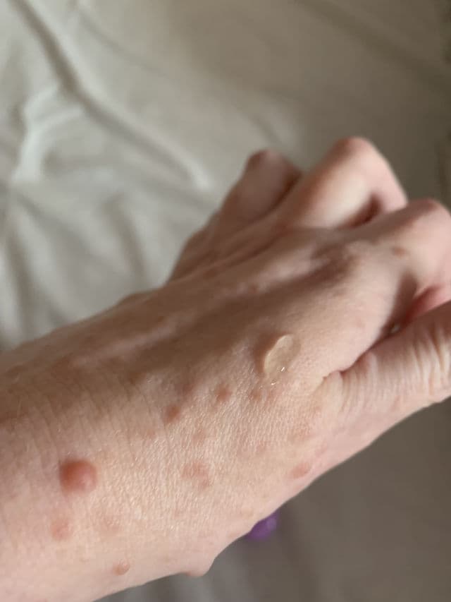 Vegan By Happy Skin Plum + Bio Retinol Night Serum review photo by Chandler