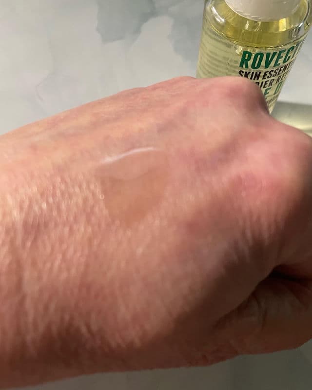 Rovectin Skin Essentials Barrier Repair Face Oil review photo by Sharonspendstoomuch