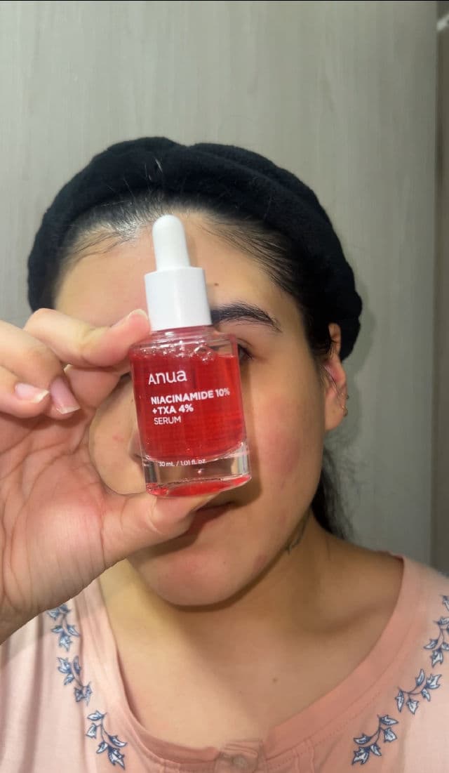Niacinamide 10% + TXA 4% Dark Spot Correcting Serum product review