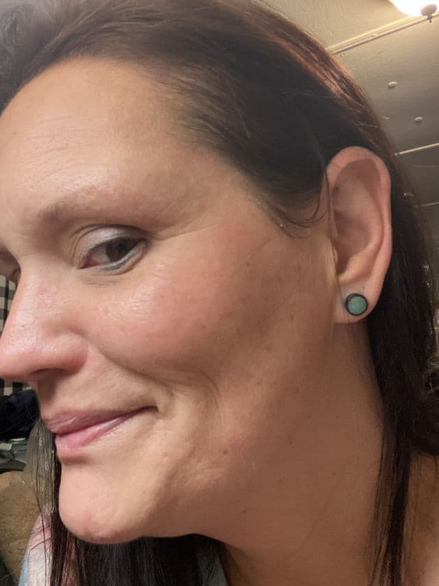 Dr.Melaxin TX Cream Plus review photo by morganne1980