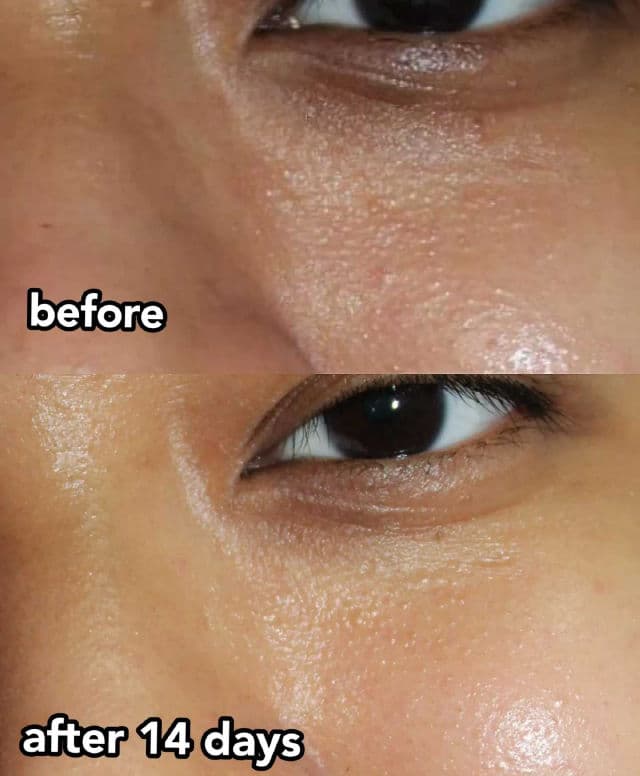 Rohto Melano CC Vitamin C Premium Essence review photo by skeengeeks