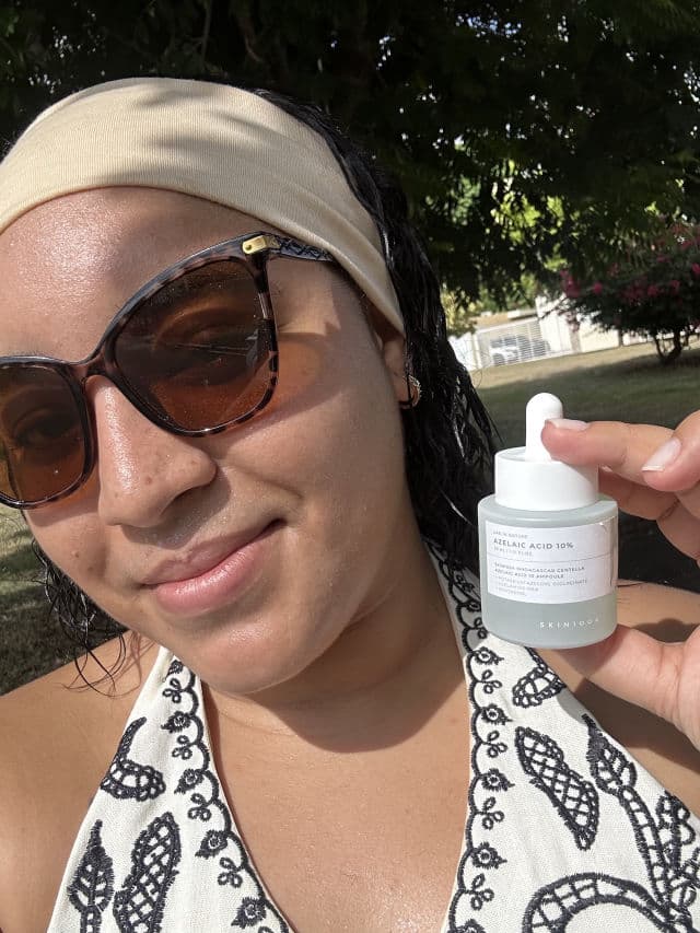 SKIN1004 Azelaic Acid 10 Ampoule review photo by smilyn