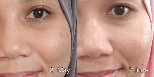 WEEDURI Beecalm Barrier Silk Moisturiser review photo by slumberlady