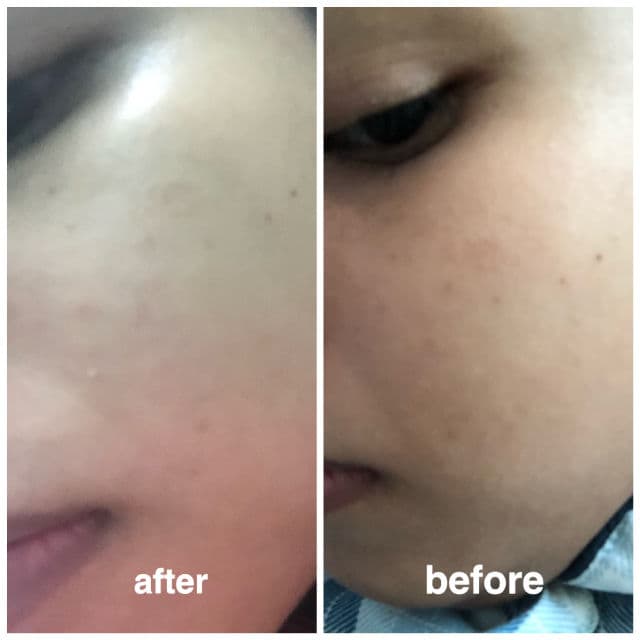 Nano White Dark Spot Corrective Serum review photo by AddaSyuhada