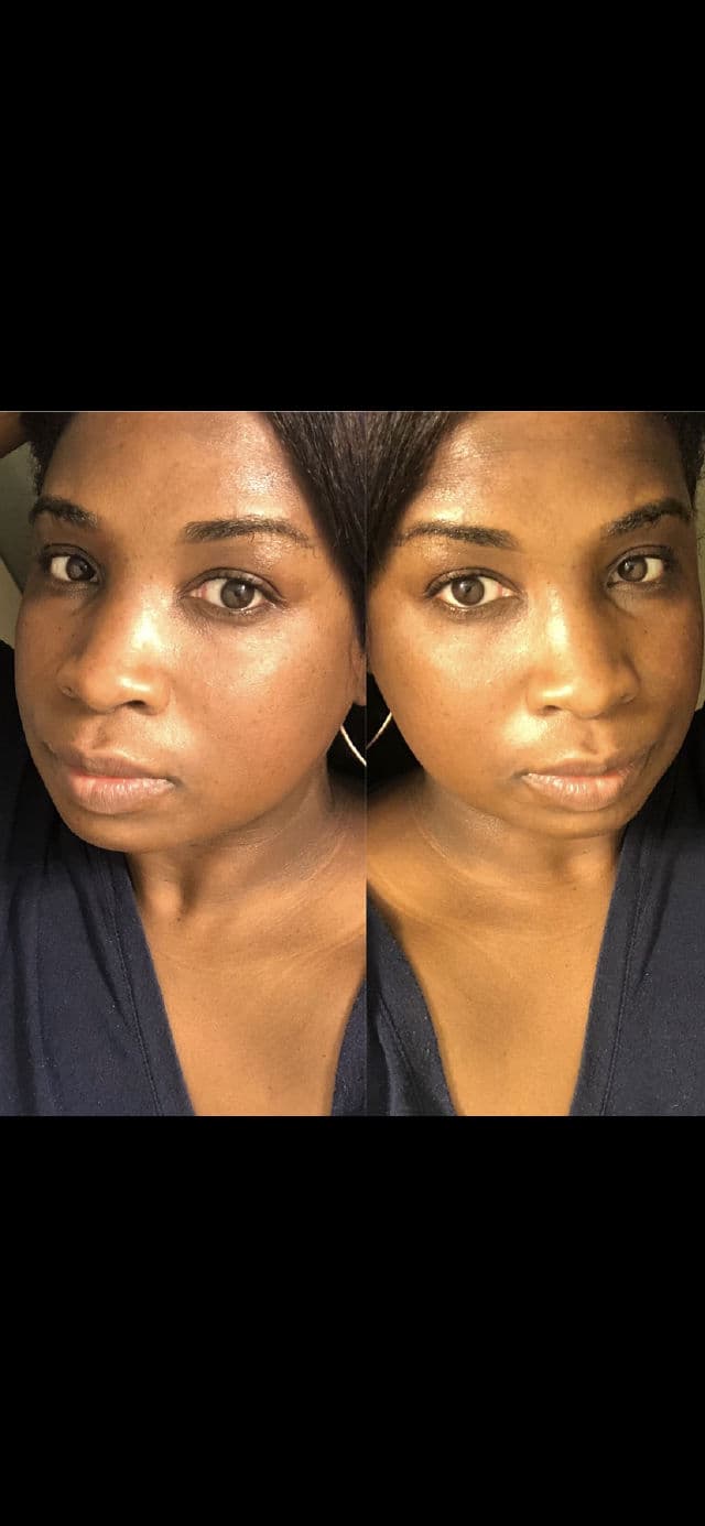 Peach & Lily ORIGINAL GLOW SHEET MASK review photo by Georgialion47