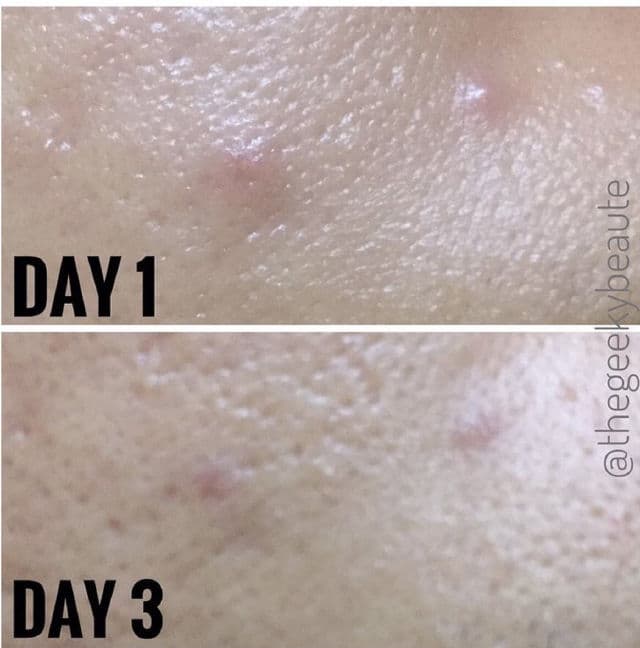 BENTON Goodbye Redness Centella Spot Cream review photo by TheGeekyBeaute