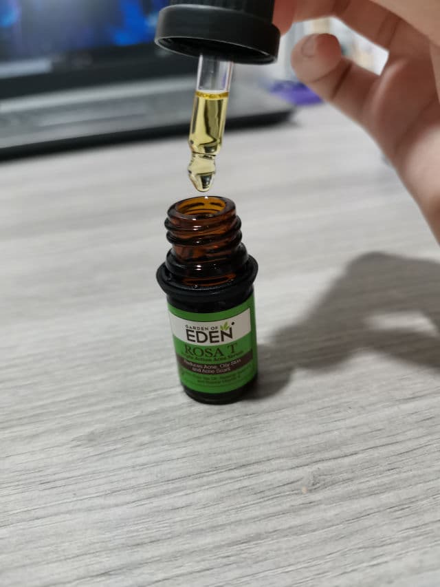Garden of Eden Rosa T Triple Action Acne Serum review photo by Wennie