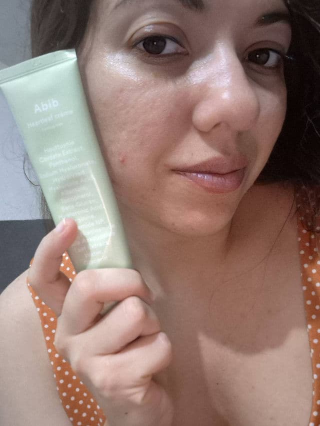 Hormonal Acne