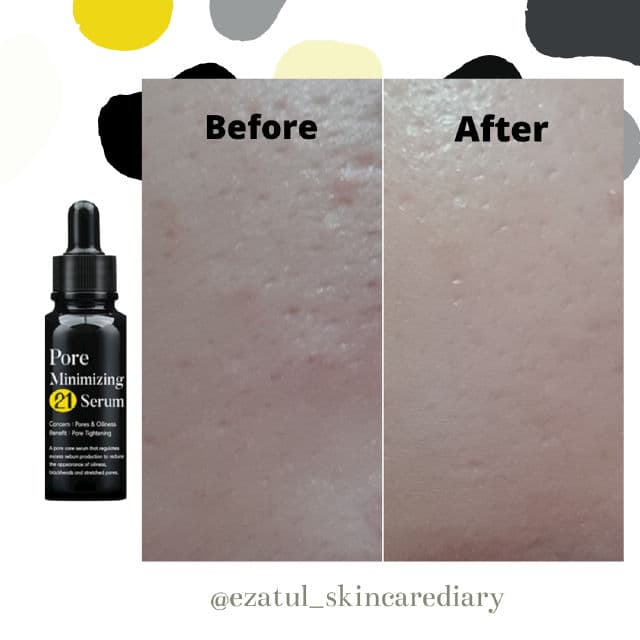 Pore Minimizing 21 Serum product review