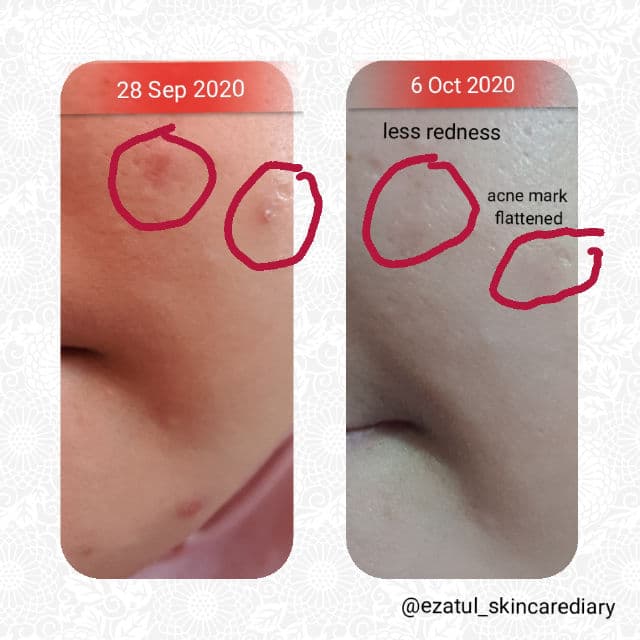 Dark Spot Correcting Glow Serum product review