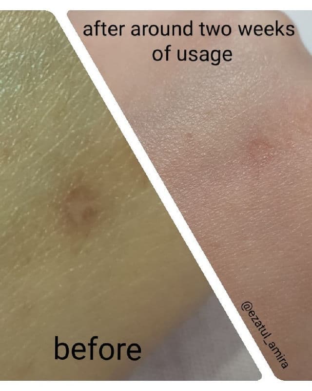 Alpha Arbutin 2% and Kojic Acid 1% Serum product review