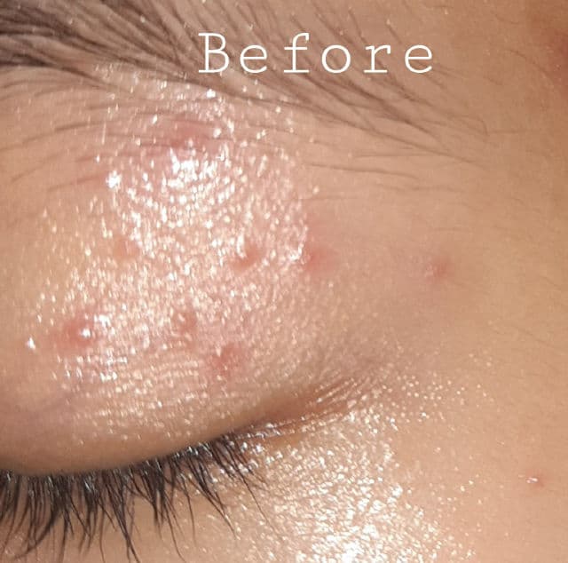 Some By Mi AHA BHA PHA 30 Days Miracle Cream review photo by gwydr