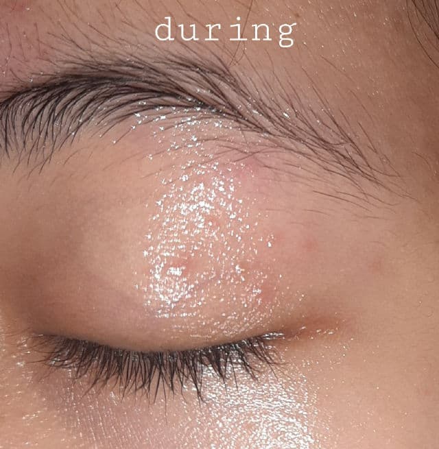 Some By Mi AHA BHA PHA 30 Days Miracle Cream review photo by gwydr