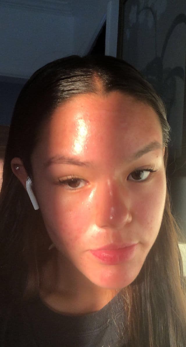 PanOxyl Benzoyl Peroxide 10% Acne Foaming Face Wash review photo by jaidyn