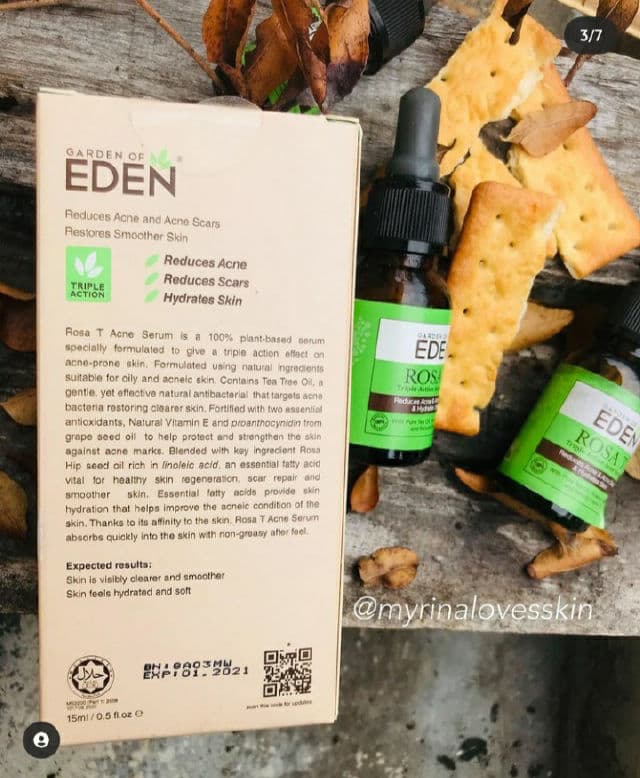 Garden of Eden Rosa T Triple Action Acne Serum review photo by myrinA
