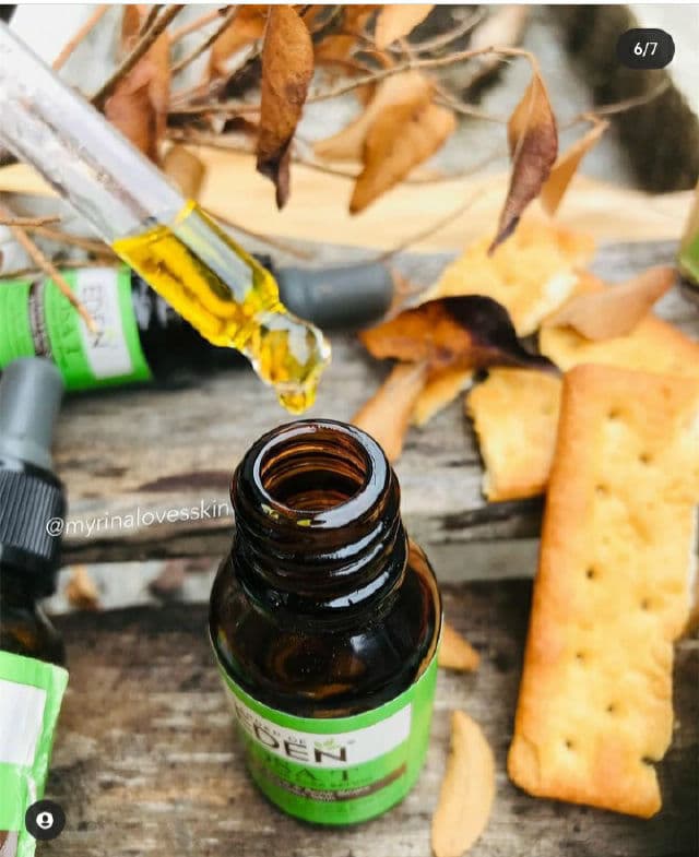 Garden of Eden Rosa T Triple Action Acne Serum review photo by myrinA