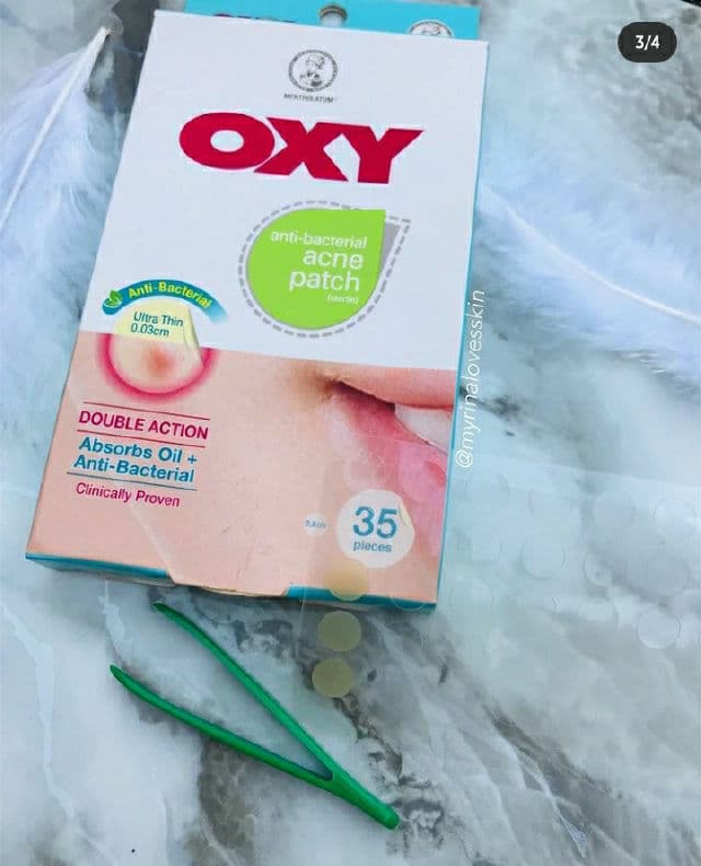 OXY Anti-Bacterial Acne Patch review photo by myrinA