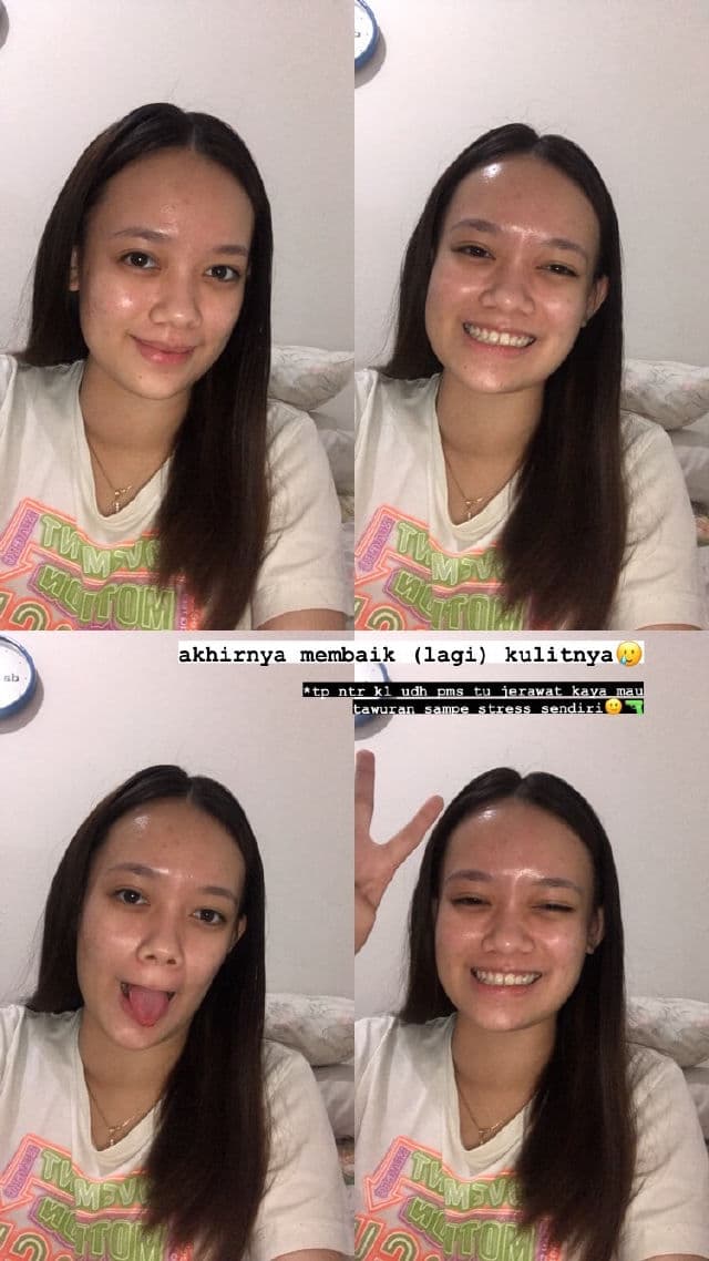 COSRX Refresh AHA BHA Vitamin C Daily Toner review photo by stellaliviana